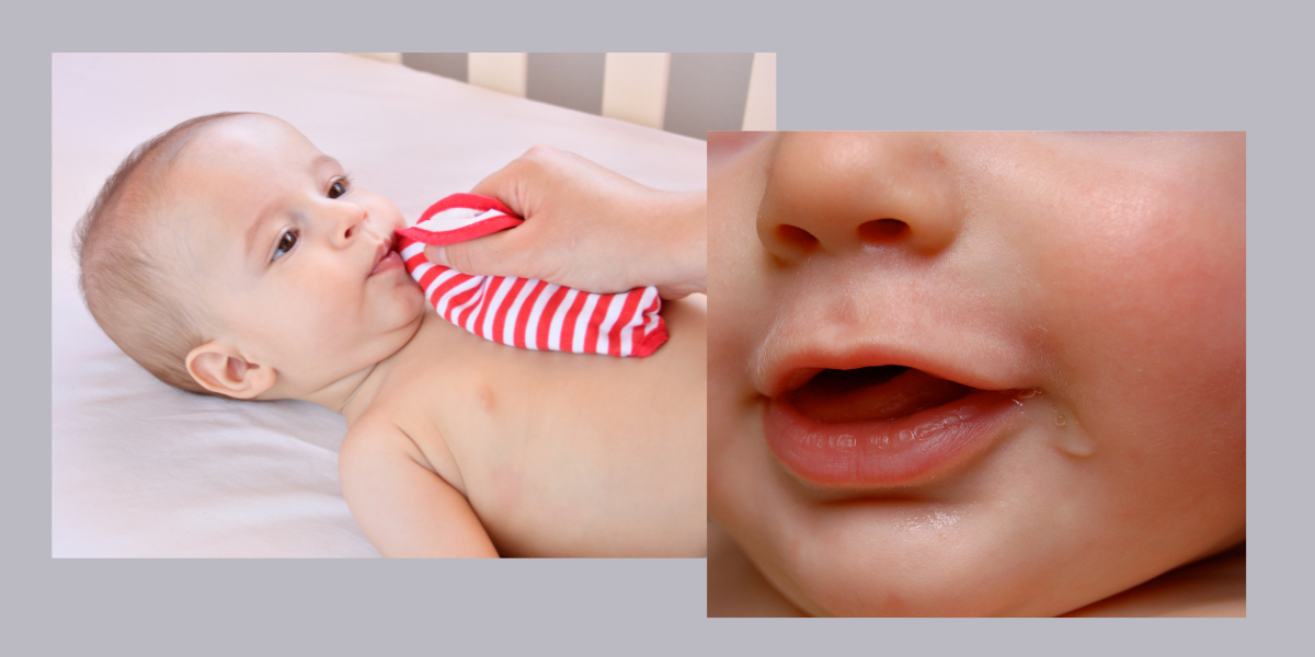 How Do I Know If My Baby Is Teething?