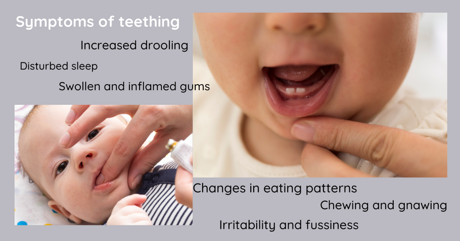 Understanding Baby's Gums: A Guide to Teething