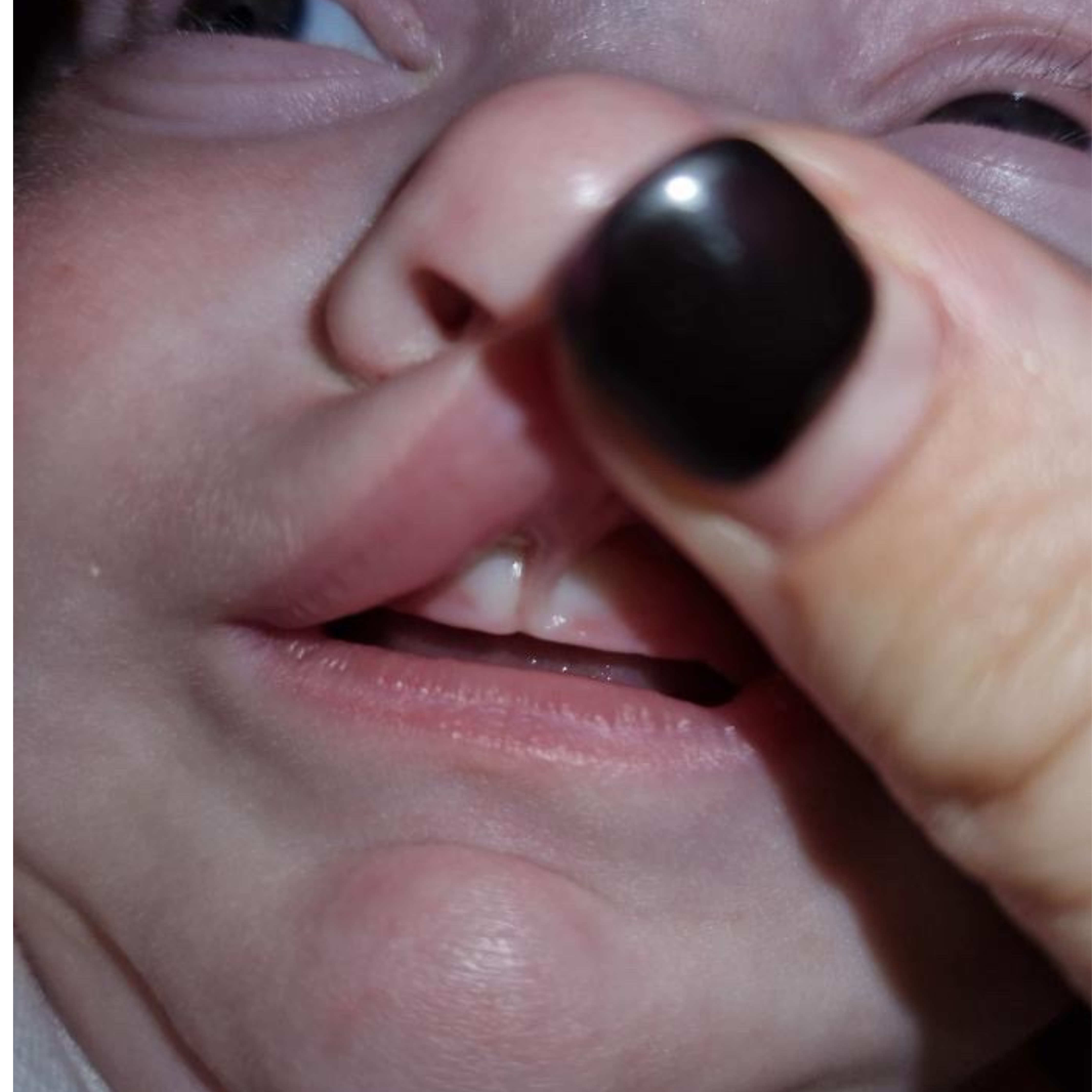 What are Epstein Pearls?