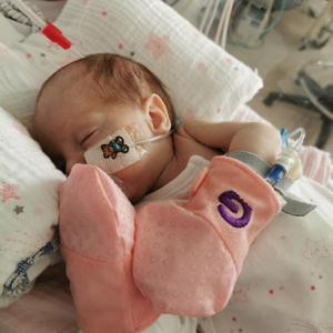 anti scratch mitts used by a preemie baby to stop tubes being pulled out